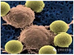 抗癌新药PV-10花落勃林格殷格翰，将在中国上市