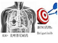 Brigatinib 用于 ALK+ 克唑替尼耐药的非小细胞肺癌