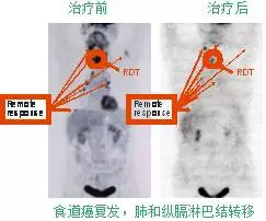 QQ图片20160726102438