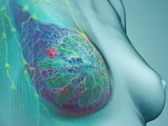 乳癌治疗新突破 两种药令肿瘤11天内消失