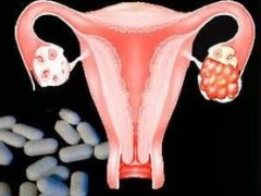 美国FDA授予卵巢癌在研新药孤儿药资格