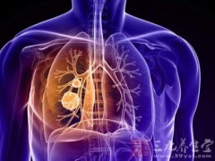 PD-1联合化疗一线治疗非小细胞肺癌获得FDA加速审批