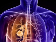 非小细胞肺癌EGFR基因靶向治疗研究进展