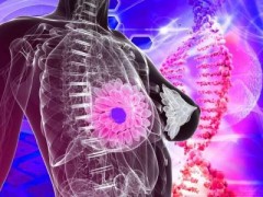 存在HER2、araf突变的乳腺癌患者如何治疗？美国foundation基因检测解读