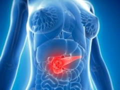 研究人员发现新的药物诱导胰腺癌细胞死亡