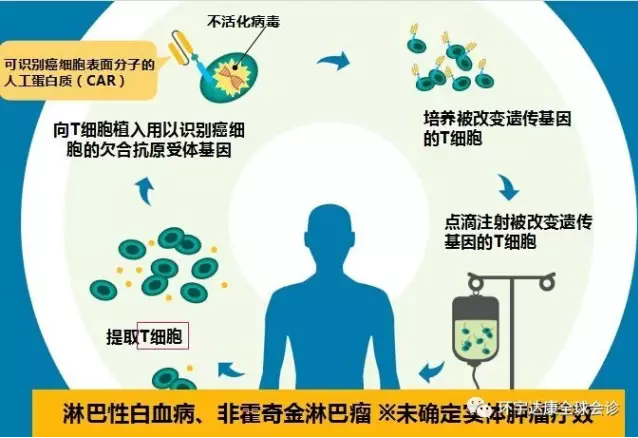免疫细胞治疗