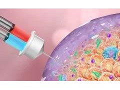 抗癌新科技！“治疗性凝胶”可有效提高杀瘤效果！