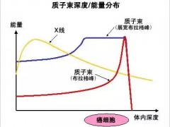 肺癌脑转移放疗,肺癌脑转移质子放疗,肺癌脑转移质子治疗带来新希望