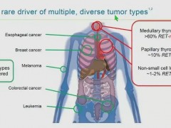 被刷屏的抗癌新药--BLU-667首次人体临床试验报告对多种癌症有效！