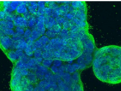治疗新靶点：DNA损伤修复的缺陷会促进ER+乳腺癌耐药