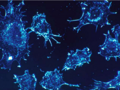 重大发现：切断肿瘤细胞供能不影响免疫细胞能量获取