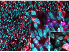 最新研究：找到阻止癌细胞生长和扩散的关键靶点