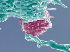 直播预告|第五代多靶点复合抗原细胞免疫疗法--癌症患者长期高质量生存的可能！