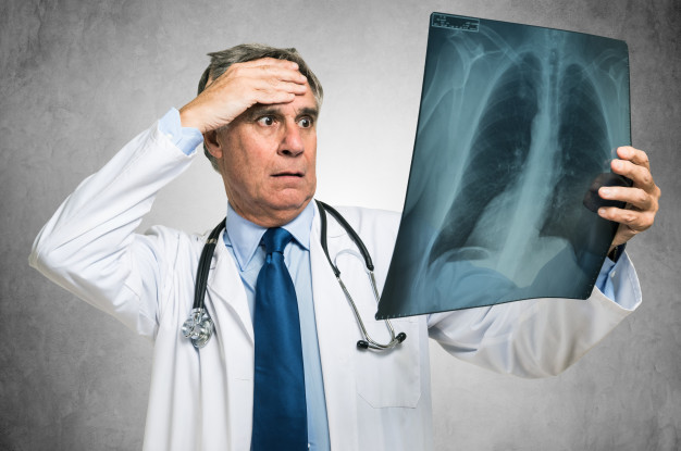 desperate-doctor-looking-at-a-lung-radiography_53419-2614