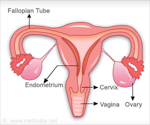 子宫内膜癌