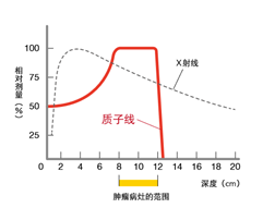 质子治疗剂量集中