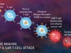 从复发到缓解：CAR T细胞治疗后淋巴瘤患者病灶完全消失！