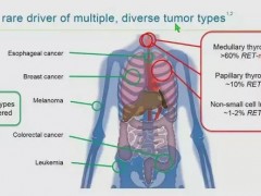 盘点｜2019非小细胞肺癌靶向治疗新靶点有哪些？