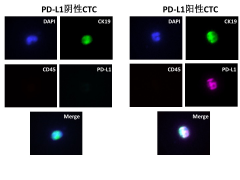 PD-1疗效预测高科技——无需肿瘤组织，4ml外周血即可搞定！