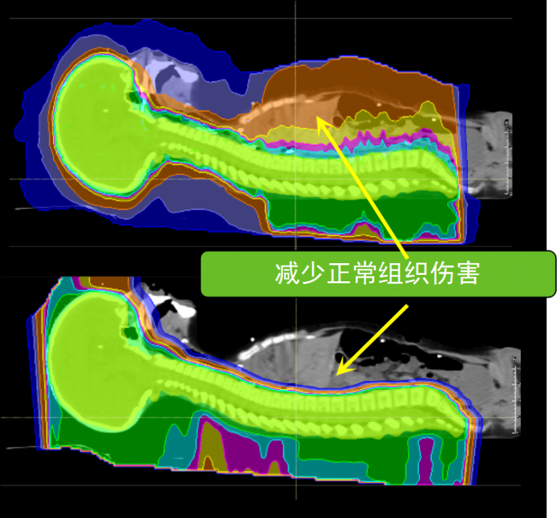 4-10-6-质子随母细胞