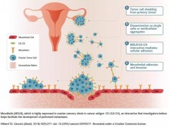 攻克癌症的新希望！五大靶向间皮素的治疗方法潜力无限！