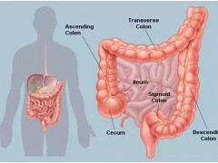结直肠癌患者注意！病灶发生在左侧和右侧治疗方案竟截然不同