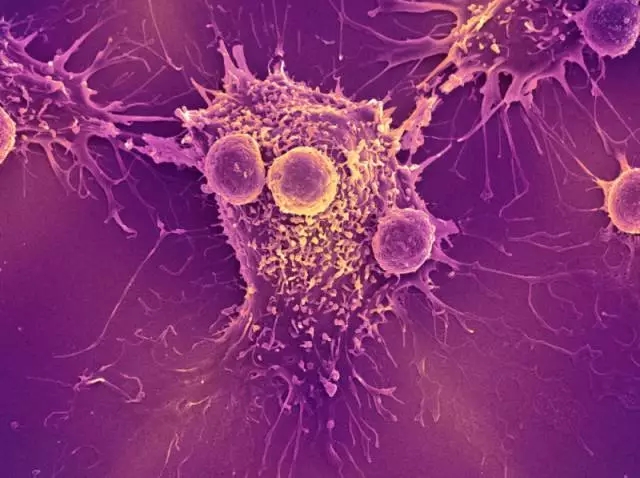 T淋巴细胞与癌细胞相互作用