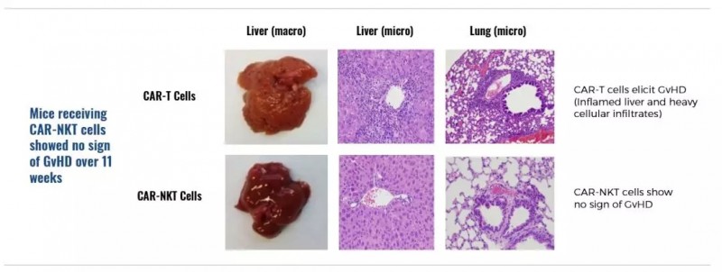 CAR转染的相同人供体的T细胞或NKT细胞