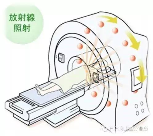 拓姆刀放疗设备