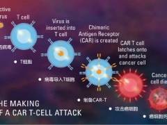 癌症多次复发陷入绝境，最后通过这一疗法救命！已经在中国问世