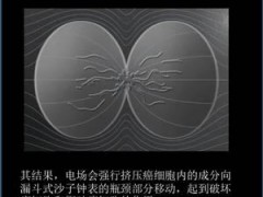 对抗最致命癌症的高科技疗法问世