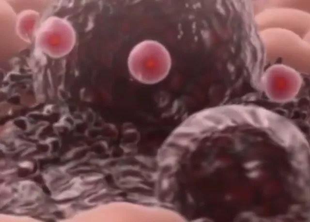粉色小球为NK细胞，紫色大球为癌细胞