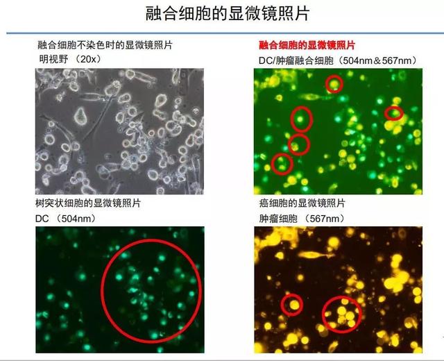 融合细胞的显微镜照片