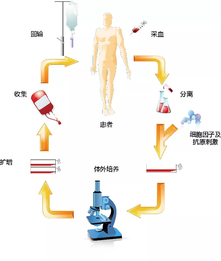 NK细胞免疫疗法治疗过程