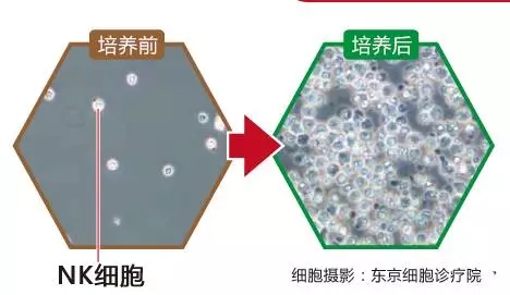 NK细胞培养前后显微镜下对比