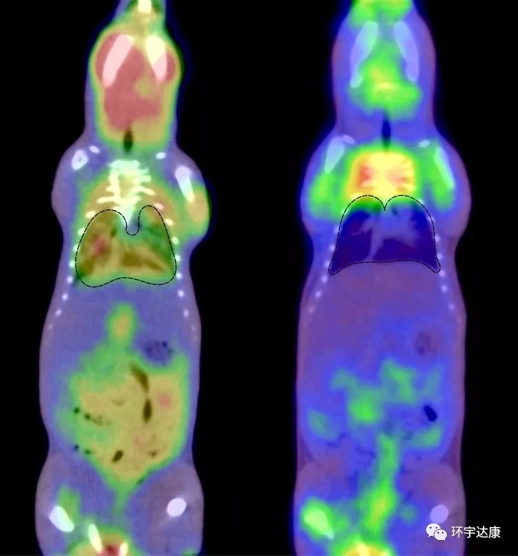 肺转移性结肠直肠癌的小鼠的PET图像