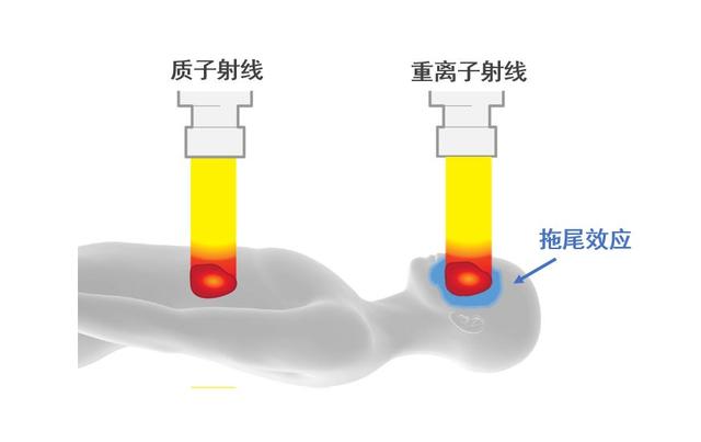 质子射线和重离子射线