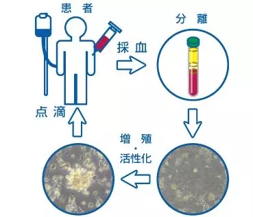 NK细胞治疗流程