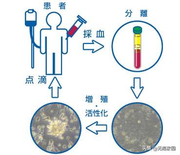 nk细胞治疗流程