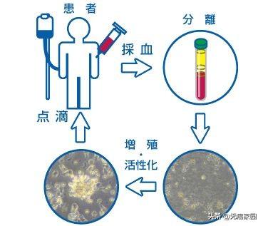 NK细胞治疗流程