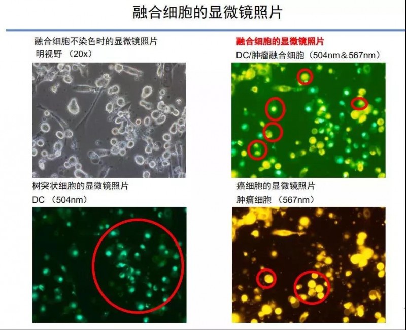 融合细胞的显微镜照片