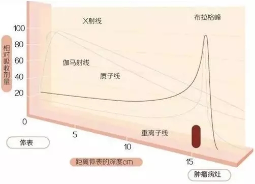 各种放射线在体内的剂量分布