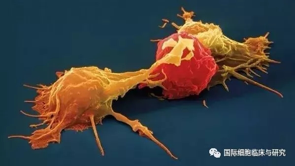 自然杀伤细胞（黄色）攻击肿瘤细胞