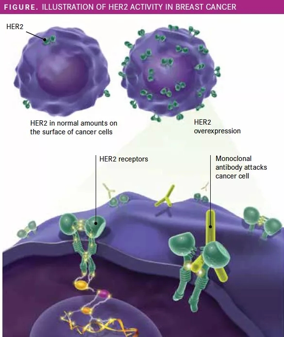 乳腺癌更具治疗意义的靶点-HER2