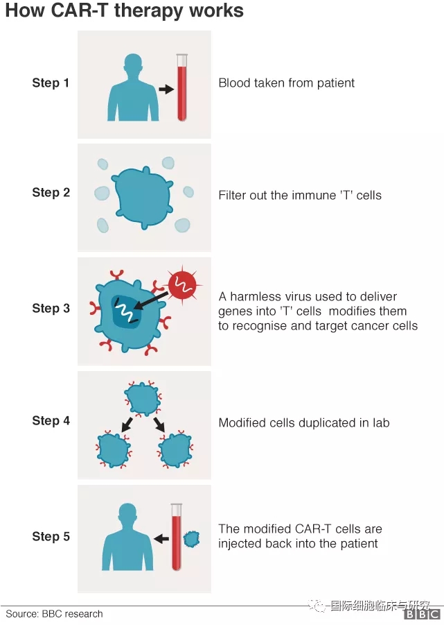 Car-T细胞免疫疗法5大步骤