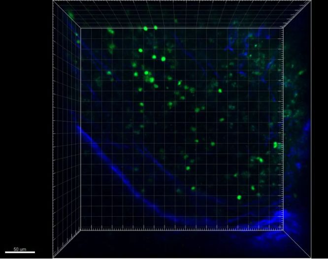 绿色显示的自然杀伤细胞攻击小鼠肿瘤
