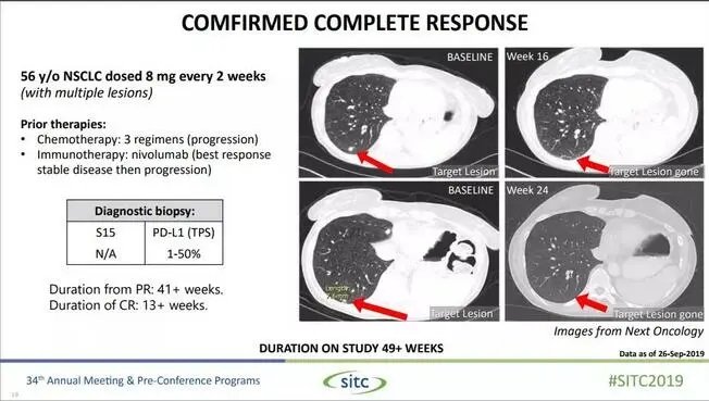 NC319肿瘤完全消失的肺癌患者治疗概况