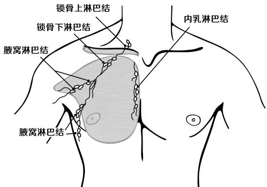 乳腺癌区域淋巴结示意图