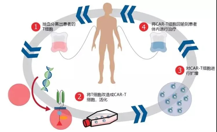 CAR-T的生产制备过程简单示意图