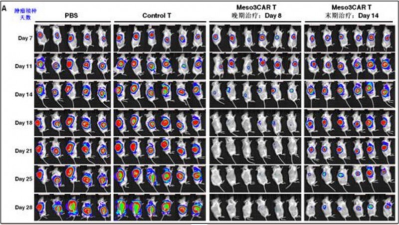接受新型间皮素CAR-T疗法的晚期卵巢癌小鼠的肿瘤出现快速消退